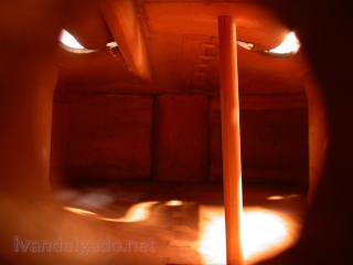 Imagen de endoscopia de violonchelo